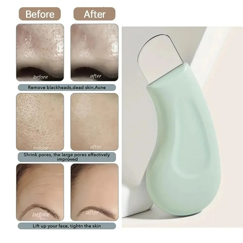 Blackhead Remover Tool for Nose and Face Skin Pore Cleaner Silicone Facial Scraper Gentle Cleansing Beauty Skin Care Tools — image 2