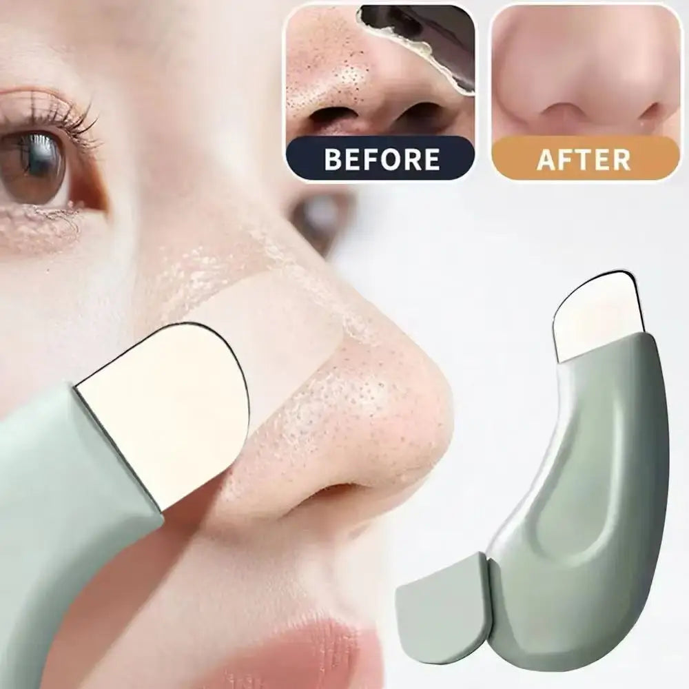 Deep Cleansing Blackhead & Whitehead Removal Tool for Nose and Face - Skin Pore Cleaner Skin Care Beauty Tools Hot Sale — image 1