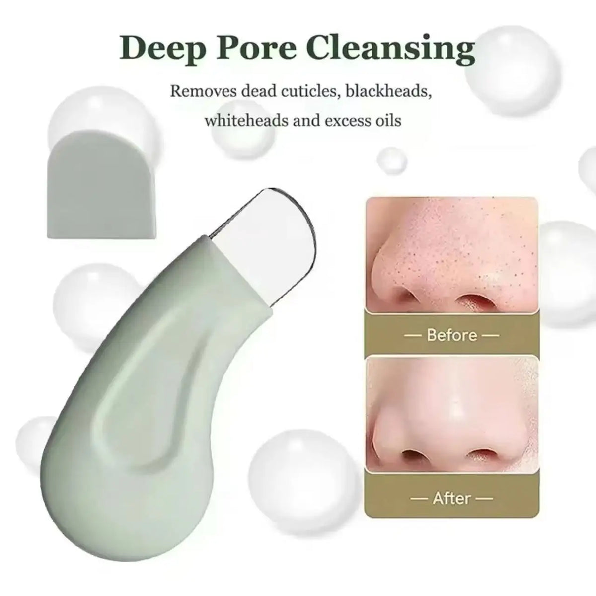 Deep Cleansing Blackhead & Whitehead Removal Tool for Nose and Face - Skin Pore Cleaner Skin Care Beauty Tools Hot Sale — image 3